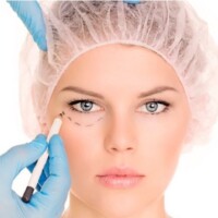 Blefaroplastia cirugia de parpados barranquilla